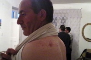 В Лернапате республиканцы и оппозиционеры ведут борьбу с помощью камней (видео)