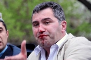 Արմեն Մարտիրոսյանին հրավիրել են ՀՔԾ