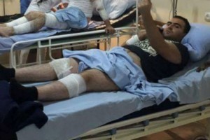 Yerevan Police Target Reporters: Percussive Grenades Injure Several
