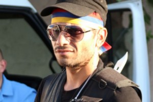 Директор медцентра “Эребуни” отрицает почернение ноги у Ованнеса Арутюняна, адвокат 
настаивает на обратном