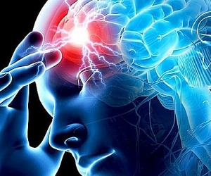 Ինսուլտի դեմ պայքարի համաշխարհային օրն է