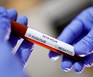 Подтвердились 79 новых новых случаев коронавирусного заболевания. Умер один пациент