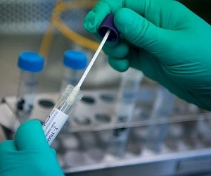 Подтвердились 547 новых случаев коронавируса. Умерли семь человек