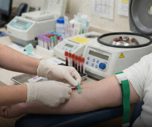 Հայաստանում ՄԻԱՎ-ի մասին դեռ խուսափում են խոսելուց. մեկ տարվա ընթացքում 514 նոր դեպք է հայտնաբերվել