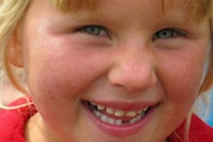 Educating minority children